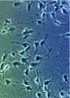 Nanomaterials Developed For Industry Triple Or Quadruple Life Of Brain Cells